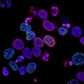 Clostridium Butyricum Probiotic